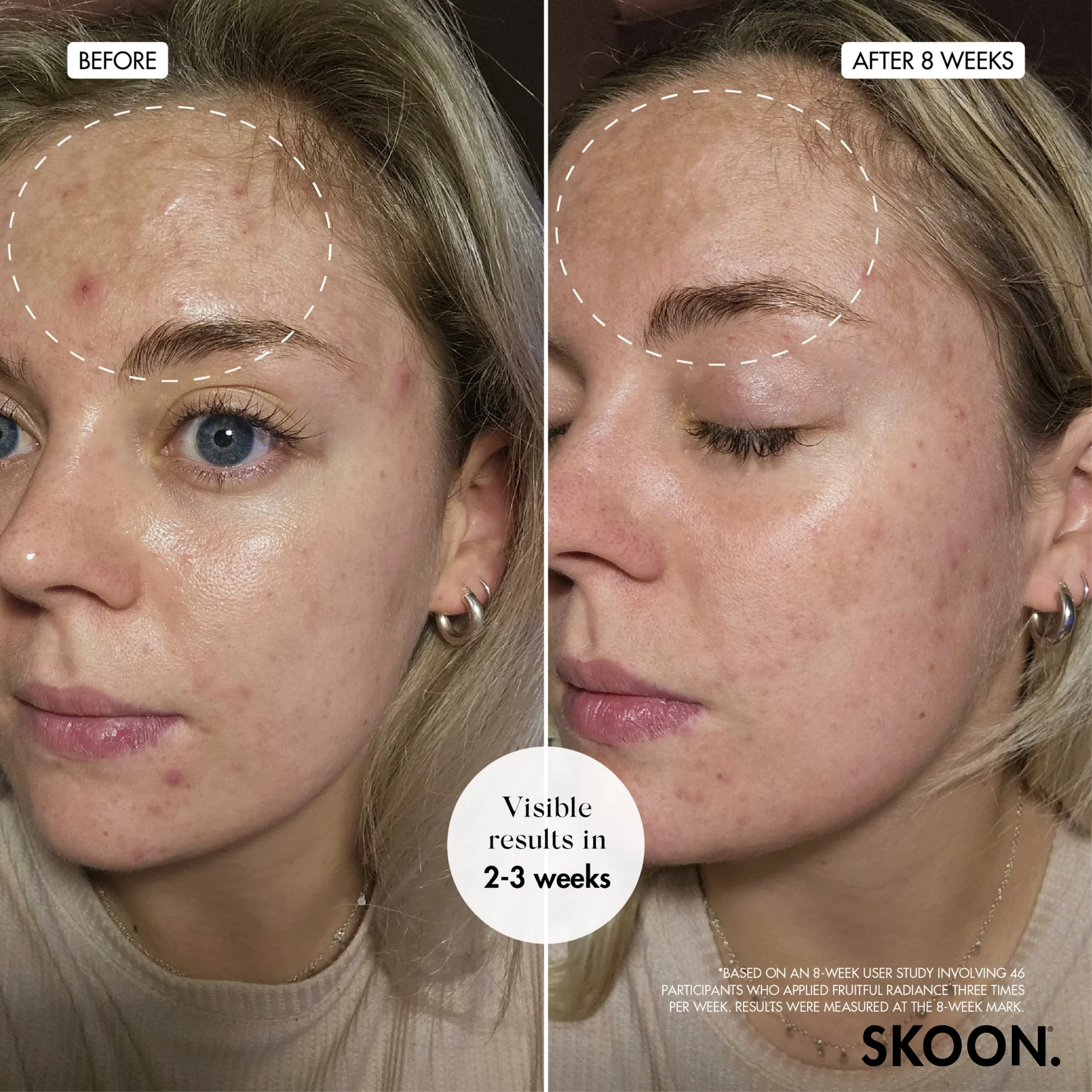 SKOON - Fruitful Radiance Renewal Night Liquid Exfoliant 100ml - Image 3