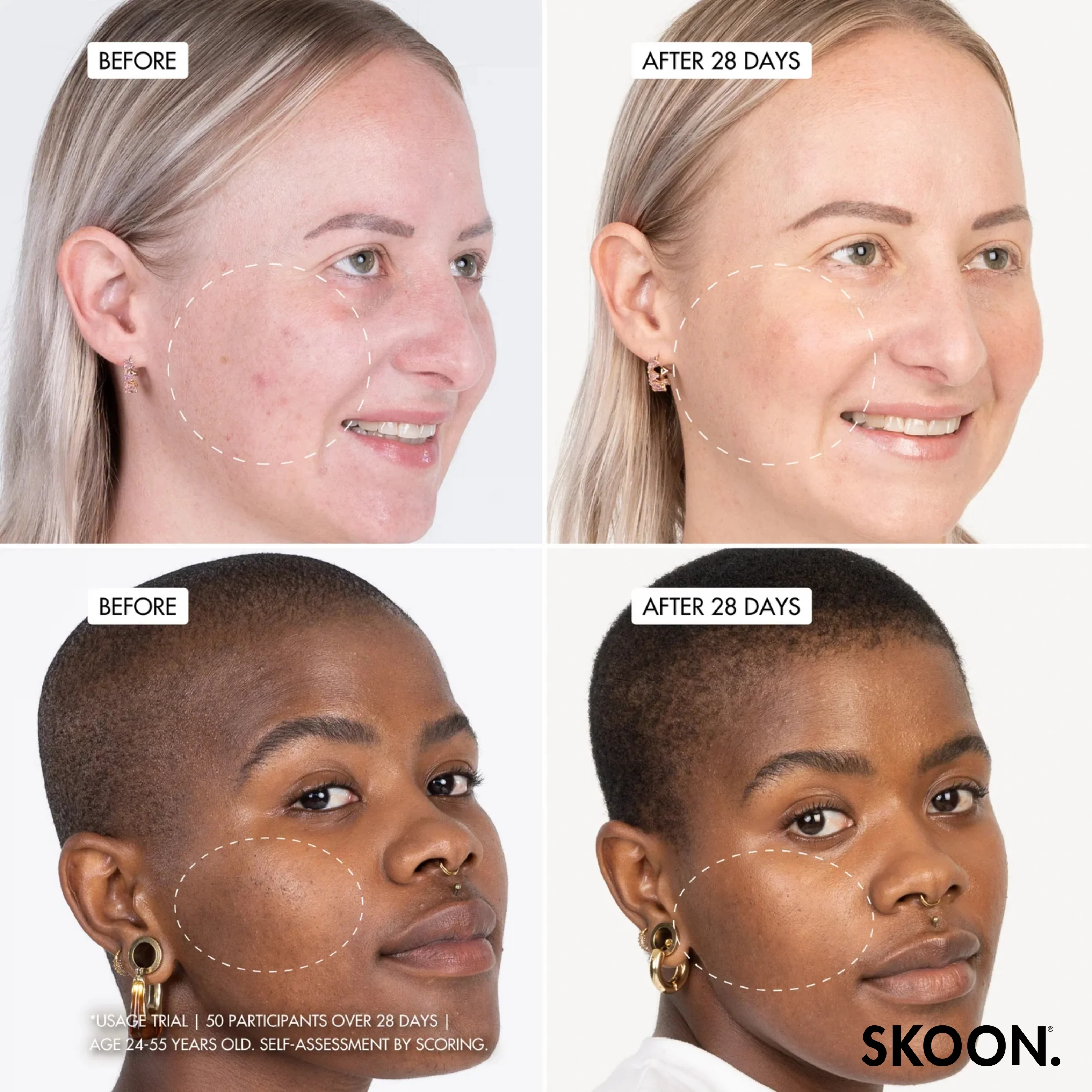 SKOON - NanoPillow B3 Barrier Boost Duo Pack - Image 4