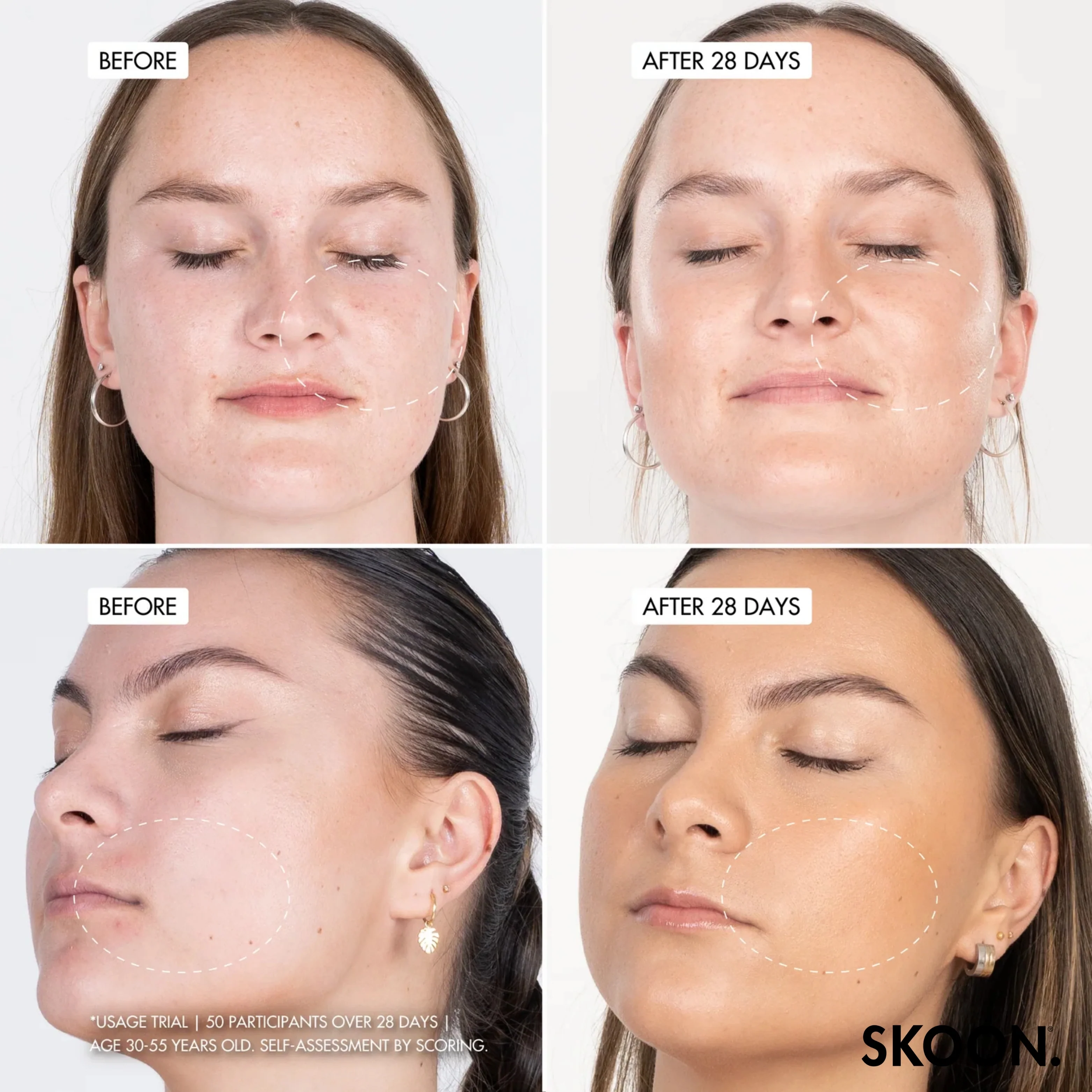 SKOON - NanoPillow Hydrosurge Duo Pack - Image 4