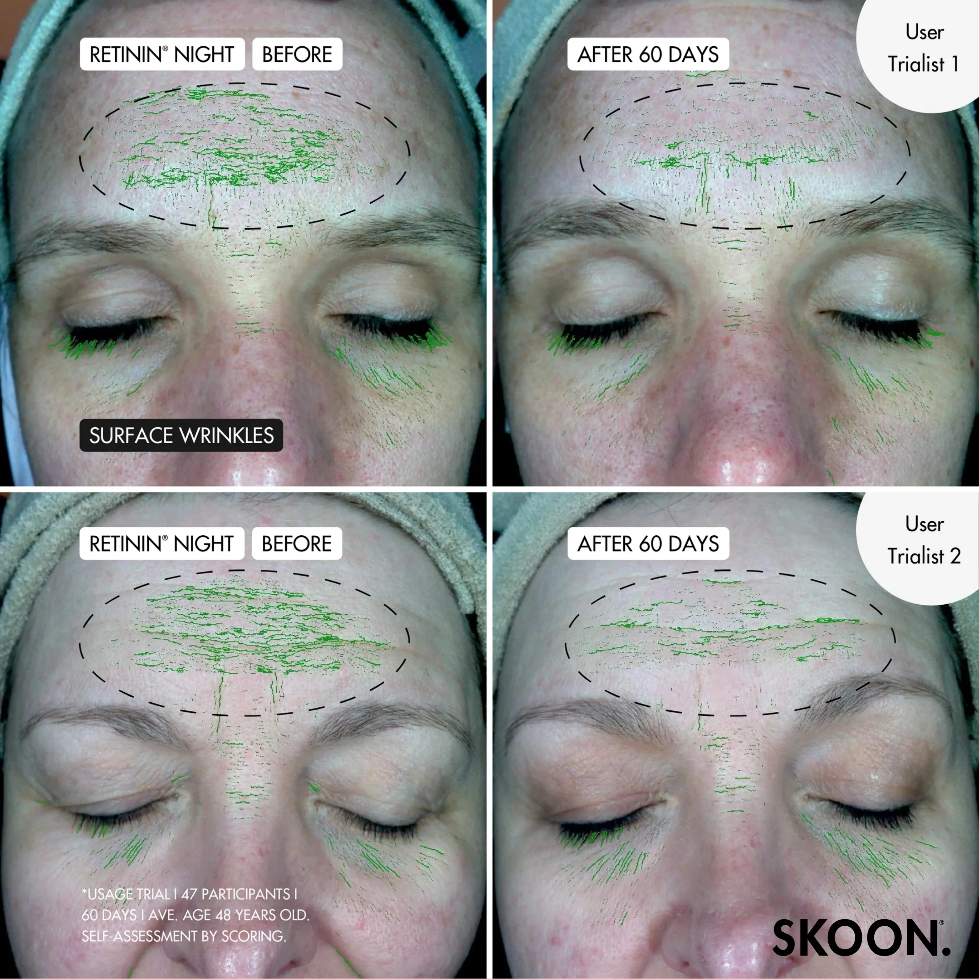 SKOON - Triple Threat (Retinin Night + WWW + Skin PJs) - Image 4